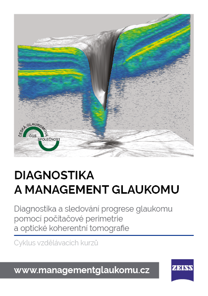 Diagnostika a management glaukomu